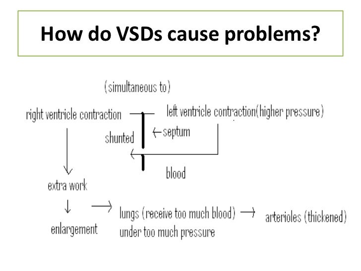 chart x ray flow Ventricular septal defect (vsd)