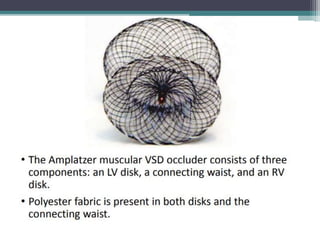 Ventricular septal defect (vsd) | PPTX