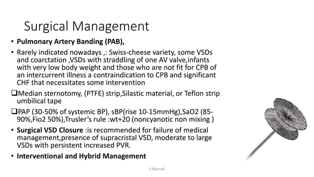 Ventricular septal defect VSD | PPT