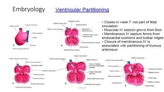 Pathway Vsd Ventricular septal defect VSD | PPTX