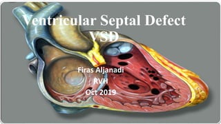 Ventricular Septal Defect
VSD
Firas Aljanadi
RVH
Oct 2019
F.Aljanadi
 