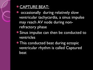 Ventricular tachyarrhythmias | PPT