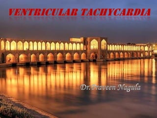 Ventricular tachycardia Dr.Praveen Nagula 