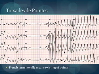 Hodge’s formulaWith increasing heart rate and younger age the Bazett and Hodges formulae overcorrect the QTc whereas the Fridericia and Framingham formulae undercorrect. The Hodges formula correlated best with the RR interval.Hodges formula: QT + 0.00175 (HR – 60) 