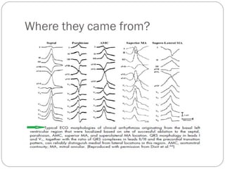 Where they came from?
 