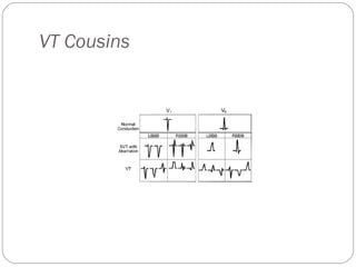 VT Cousins
 