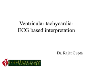 Ventricular tachycardia-
ECG based interpretation
Dr. Rajat Gupta
 