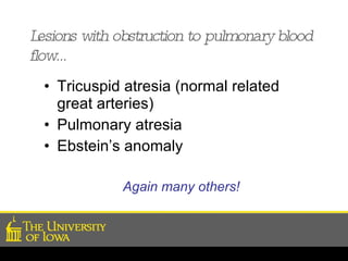 Lesions with obstruction to pulmonary blood flow… Tricuspid atresia (normal related great arteries) Pulmonary atresia Ebstein’s anomaly Again many others! 