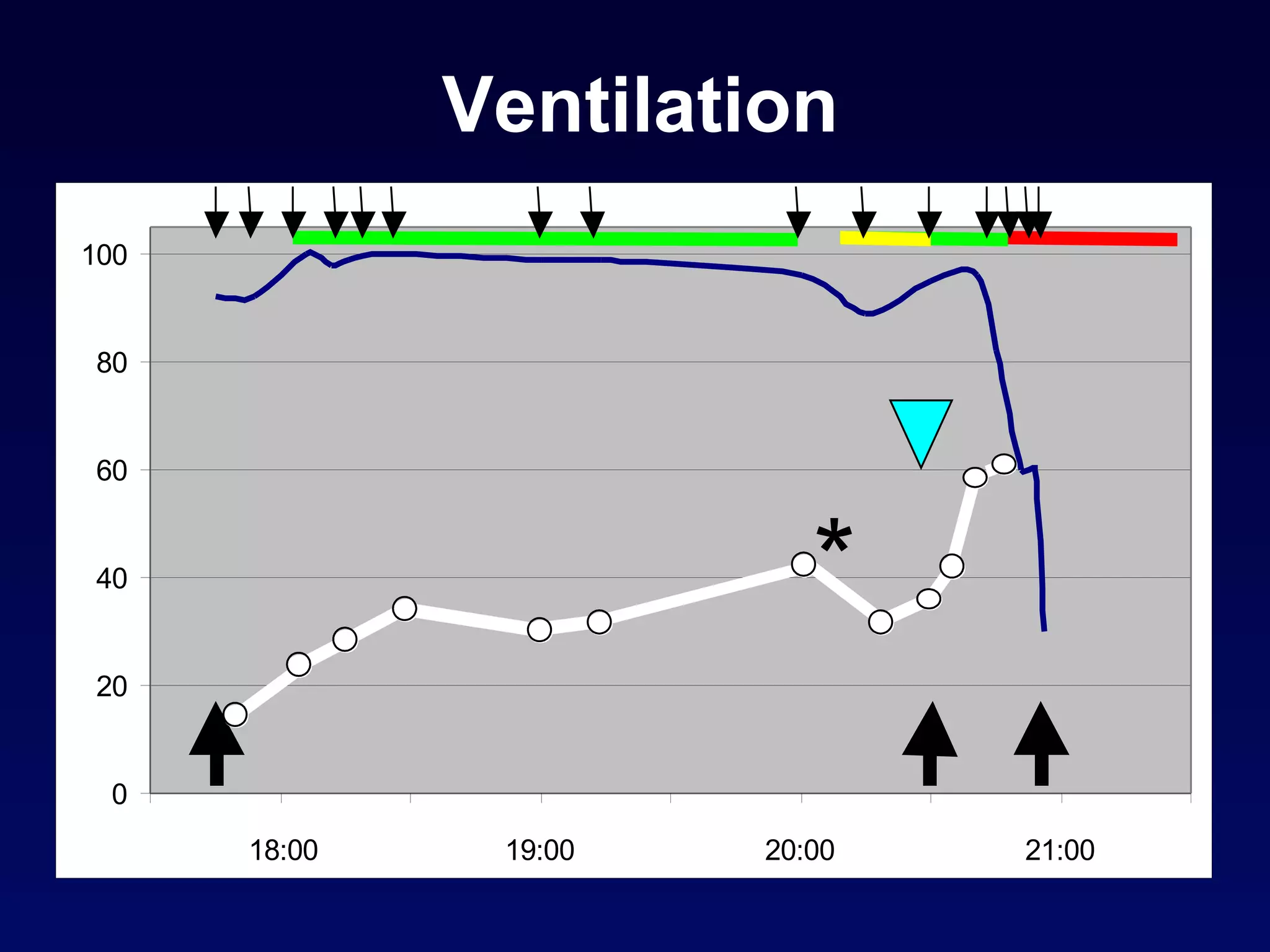Ventilation 