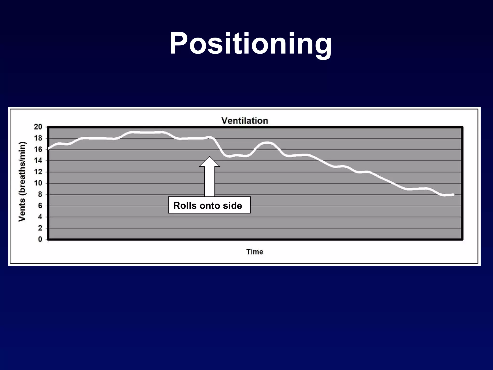 Positioning Rolls onto side 
