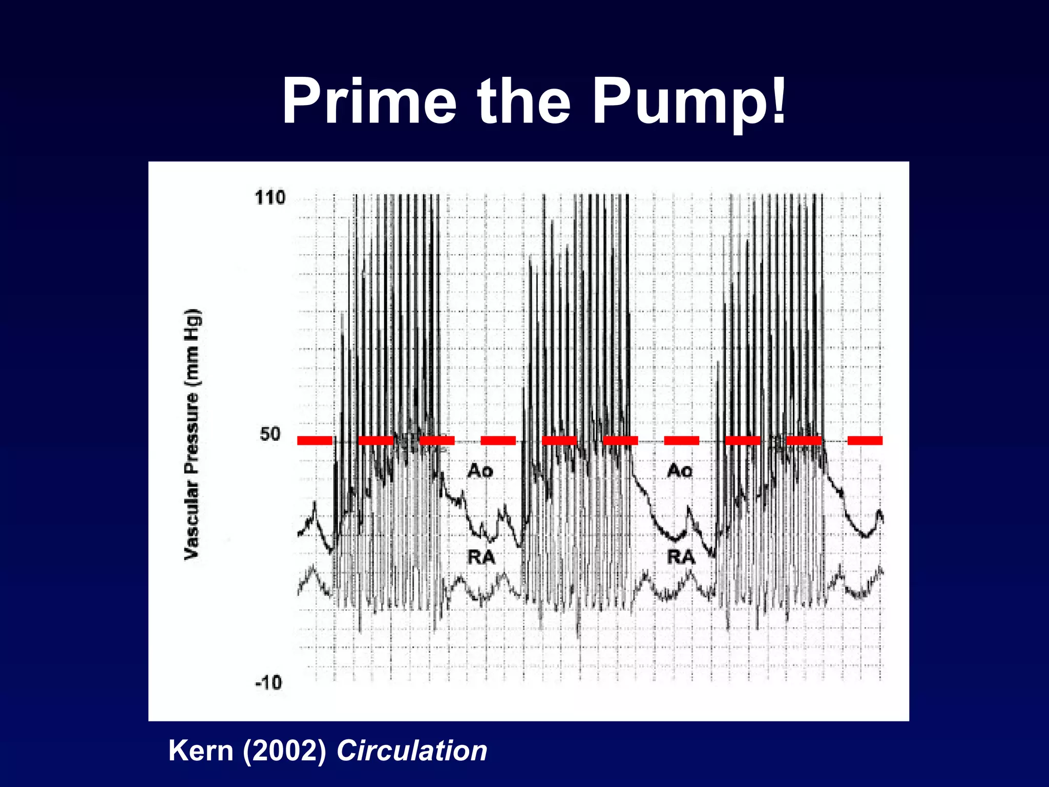 Prime the Pump! Kern (2002)  Circulation 