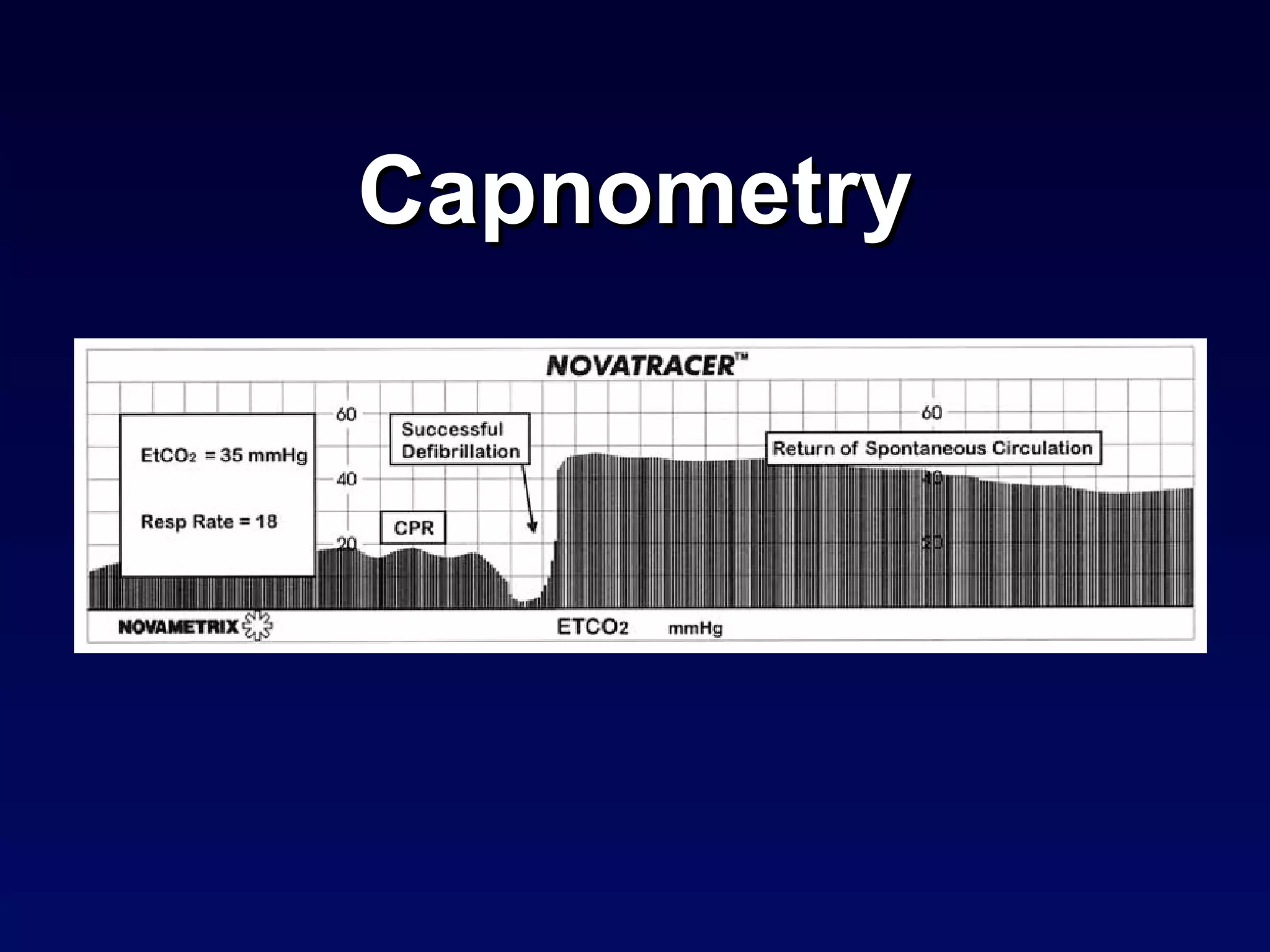 Capnometry 