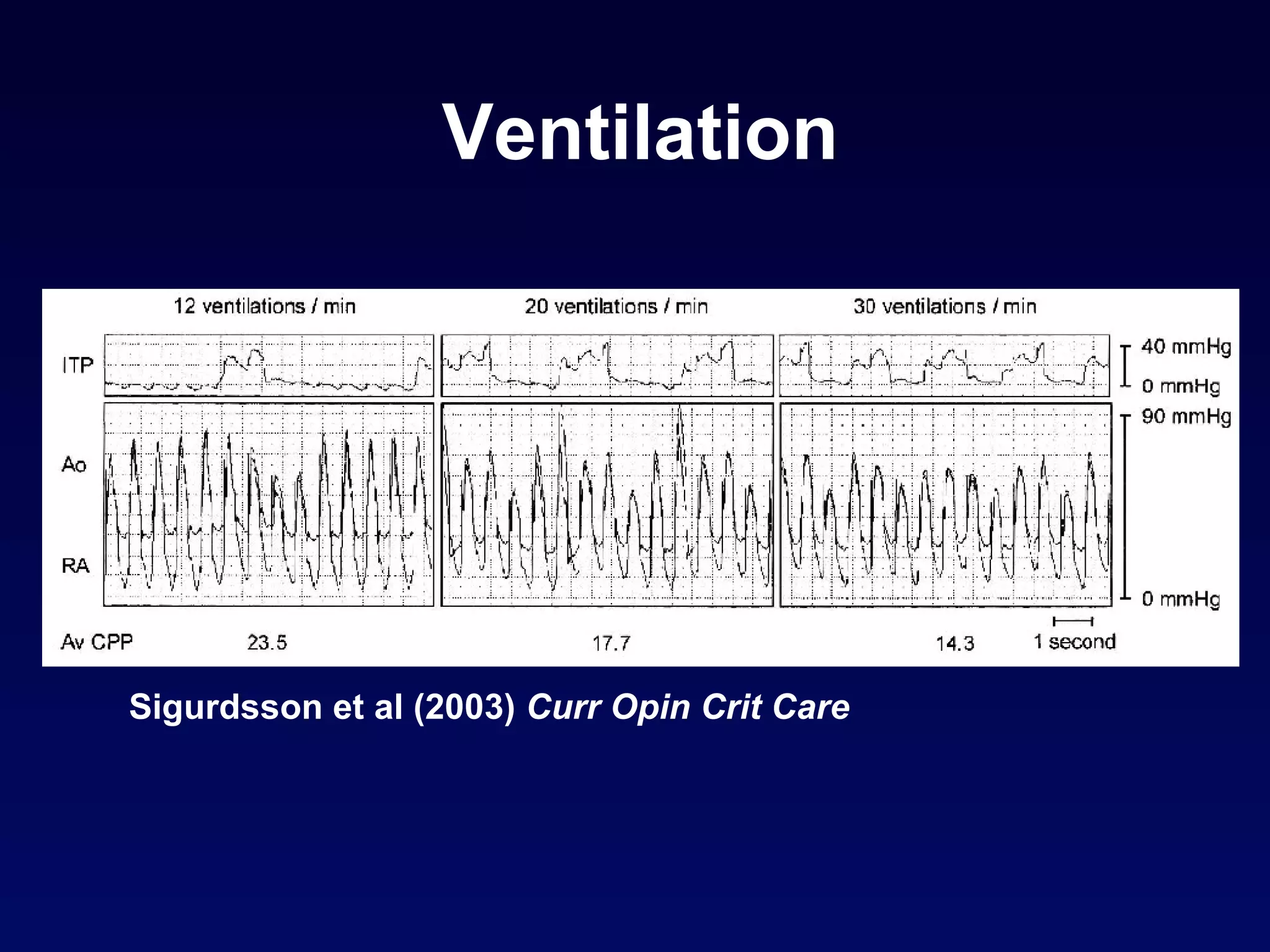 Ventilation Sigurdsson et al (2003)  Curr Opin Crit Care 