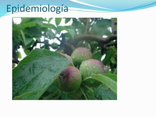 Epidemiología 
 