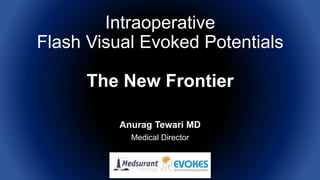 Intraoperative
Flash Visual Evoked Potentials
The New Frontier
Anurag Tewari MD
Medical Director
 