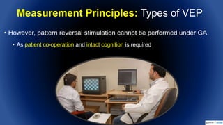 Intraoperative Flash Visual Evoked Potentials | PPTX