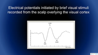 Intraoperative Flash Visual Evoked Potentials | PPTX