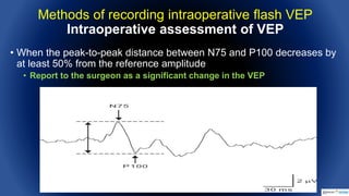 Intraoperative Flash Visual Evoked Potentials | PPTX