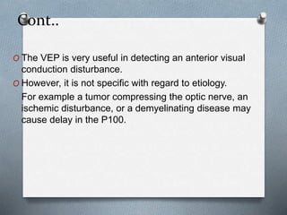 Cont..
O The VEP is very useful in detecting an anterior visual
conduction disturbance.
O However, it is not specific with...