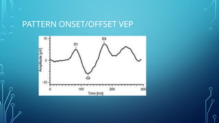 Visual evoked potential when to use and how to interpret | PPTX