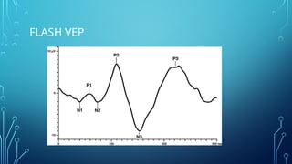 Visual evoked potential when to use and how to interpret | PPTX