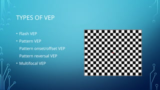 Visual evoked potential when to use and how to interpret | PPTX