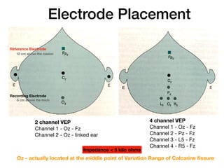 Electrode Placement
2 channel VEP
Channel 1 - Oz - Fz

Channel 2 - Oz - linked ear
4 channel VEP
Channel 1 - Oz - Fz

Channel 2 - Pz - Fz

Channel 3 - L5 - Fz

Channel 4 - R5 - Fz
Impedance < 5 kilo ohms
Oz - actually located at the middle point of Variation Range of Calcarine fissure
12 cm above the nasion
Reference Electrode
Recording Electrode
5 cm above the Inion
 