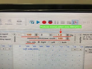 Produces reversal pattern every 500ms/0.5 s
 