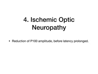 4. Ischemic Optic
Neuropathy
• Reduction of P100 amplitude, before latency prolonged.
 