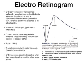 Electro Retinogram
• ERG can be recorded from corneal
surface by a contact lens embedded with
a corneal ring electrode, and a
conjunctival reference from periorbital
skin , by small electrodes attached at the
lateral canthi.

• Stimulus - Strobe light, (ganz field -
whole field)

• Cones - shorter refractory period -
therefore a high frequency stimulus can
be used to assess. (30hz)

• Rods - (20hz)

• Typically recorded with patient’s pupils
Dilated after mydriatics

• ERG responses classified negative when
dips below baseline, positive when goes
above.
A - stimulation of photoreceptors (rods and cones) 15ms
B - activation of retinal interneurons from inner nuclear
layer 30-35ms
C wave - retinal pigment epithelium
D wave - OFF bipolar cells
 