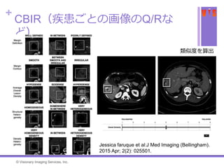 +
CBIR（疾患ごとの画像のQ/Rな
ど）
Jessica faruque et al:J Med Imaging (Bellingham).
2015 Apr; 2(2): 025501.
類似度を算出
© Visionary Imaging Services, Inc.
 