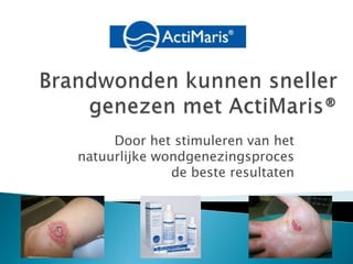 Brandwonden kunnen sneller genezen met ActiMaris® Door het stimuleren van het natuurlijke wondgenezingsproces    de beste resultaten 