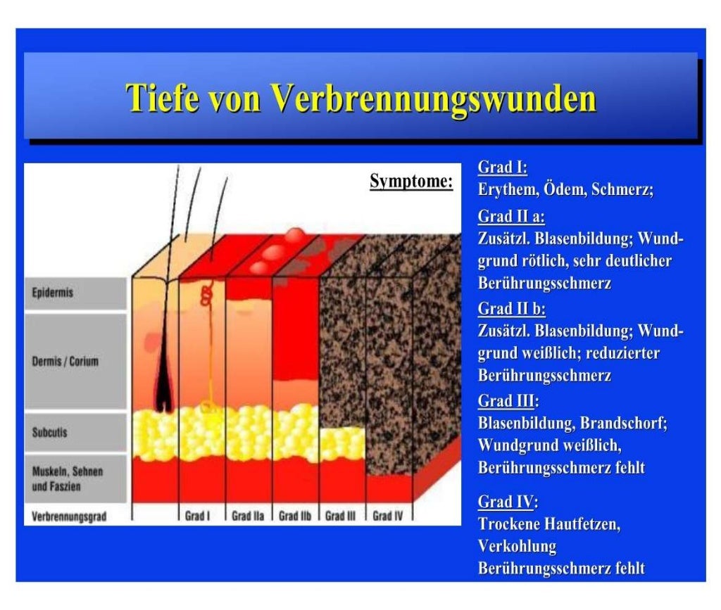 Verbrennungen. Verbrennung und allgemeine Wundheilungsmaßnahmen. Verb…