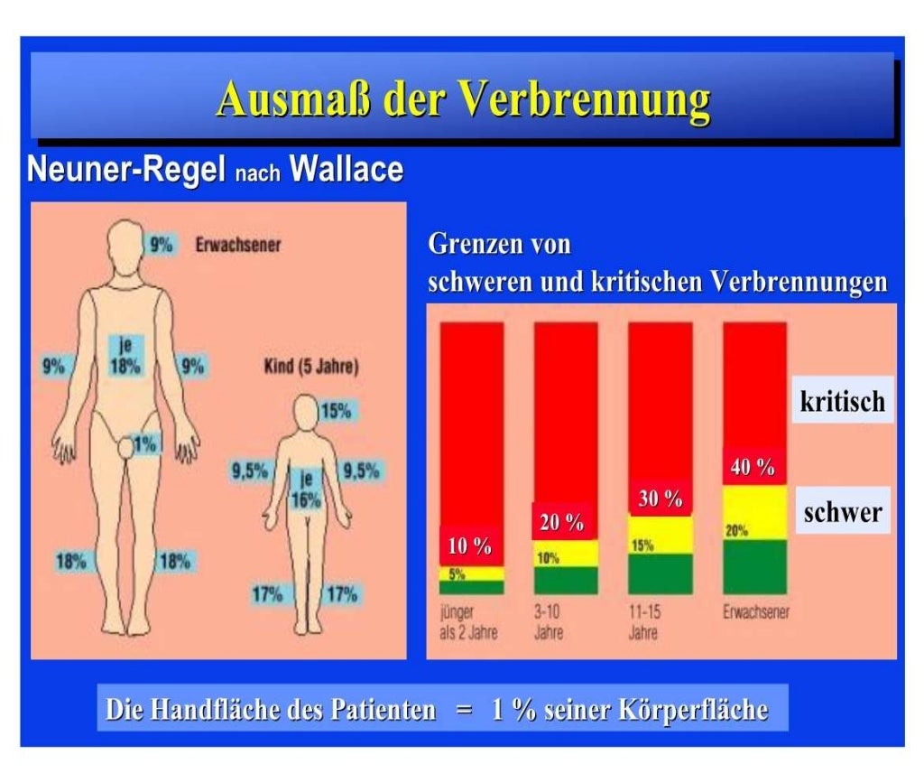 Verbrennungen. Verbrennung und allgemeine Wundheilungsmaßnahmen. Verb…