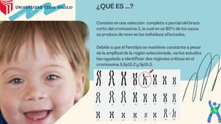 Consiste en una selección completa o parcial del brazo
corto del cromosoma 5, la cual en un 80% de los casos
se produce de novo en los individuos afectados.
Debido a que el fenotipo se mantiene constante a pesar
de la amplitud de la región seleccionada, varios estudios
han ayudado a identificar dos regiones críticas en el
cromosoma 5;5p15.2 y 5p15.3.
¿QUÉ ES ...?
 