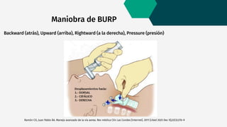 Intubación Endotraqueal: Técnicas, Anatomía y Manejo Clínico Completo | PDF