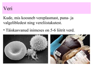 Veri K ude, mis koosneb vereplasmast, puna- ja valgelibledest ning vereliistakutest.   Täiskasvanud inimeses on  5- 6 liitrit verd.   