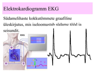 Elektrokardiogramm EKG Südamelihaste kokkutõmmete graafiline üleskirjutus, mis iseloomustab südame tööd ja seisundit. 