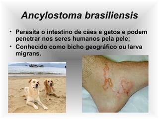 Ancylostoma brasiliensis
• Parasita o intestino de cães e gatos e podem
penetrar nos seres humanos pela pele;
• Conhecido como bicho geográfico ou larva
migrans.
 
