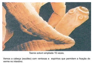 Taenia solium ampliada 15 vezes.
Vemos a cabeça (escólex) com ventosas e espinhos que permitem a fixação do
verme no intestino.
 