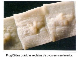 Proglótides grávidas repletas de ovos em seu interior.
 