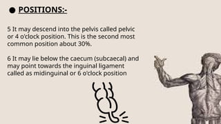 ● POSITIONS:-
5 It may descend into the pelvis called pelvic
or 4 o'clock position. This is the second most
common position about 30%.
6 It may lie below the caecum (subcaecal) and
may point towards the inguinal ligament
called as midinguinal or 6 o'clock position
 
