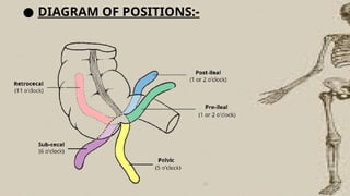 ● DIAGRAM OF POSITIONS:-
 