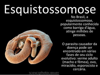 Esquistossomose 
No Brasil, a 
esquistossomose, 
popularmente conhecida 
como barriga d'água, 
atinge milhões de 
pessoas. 
O parasita causador da 
doença pode ser 
encontrado em várias 
fases de seu ciclo 
evolutivo: verme adulto 
(macho e fêmea), ovo, 
miracídio, esporocisto e 
cercária. 
 