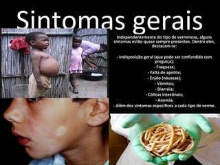 Sintomas gerais 
Independentemente do tipo de verminose, alguns 
sintomas estão quase sempre presentes. Dentre eles, 
destacam-se: 
- Indisposição geral (que pode ser confundida com 
preguiça); 
- Fraqueza; 
- Falta de apetite; 
- Enjôo (náuseas); 
- Vômitos; 
- Diarréia; 
- Cólicas intestinais; 
- Anemia; 
- Além dos sintomas específicos a cada tipo de verme. 
 