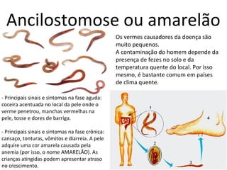 Ancilostomose ou amarelão 
Os vermes causadores da doença são 
muito pequenos. 
A contaminação do homem depende da 
presença de fezes no solo e da 
temperatura quente do local. Por isso 
mesmo, é bastante comum em países 
de clima quente. 
- Principais sinais e sintomas na fase aguda: 
coceira acentuada no local da pele onde o 
verme penetrou, manchas vermelhas na 
pele, tosse e dores de barriga. 
- Principais sinais e sintomas na fase crônica: 
cansaço, tonturas, vômitos e diarreia. A pele 
adquire uma cor amarela causada pela 
anemia (por isso, o nome AMARELÃO). As 
crianças atingidas podem apresentar atraso 
no crescimento. 
 