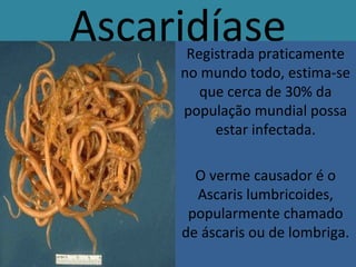Ascaridíase 
Registrada praticamente 
no mundo todo, estima-se 
que cerca de 30% da 
população mundial possa 
estar infectada. 
O verme causador é o 
Ascaris lumbricoides, 
popularmente chamado 
de áscaris ou de lombriga. 
 