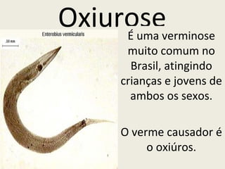 Oxiurose 
É uma verminose 
muito comum no 
Brasil, atingindo 
crianças e jovens de 
ambos os sexos. 
O verme causador é 
o oxiúros. 
 
