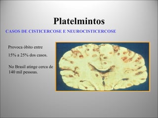 Platelmintos
CASOS DE CISTICERCOSE E NEUROCISTICERCOSE


Provoca óbito entre
15% a 25% dos casos.

 No Brasil atinge cerca de
 140 mil pessoas.
 
