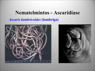 Nematelmintos - Ascaridíase
Ascaris lumbricoides (lombriga)
 